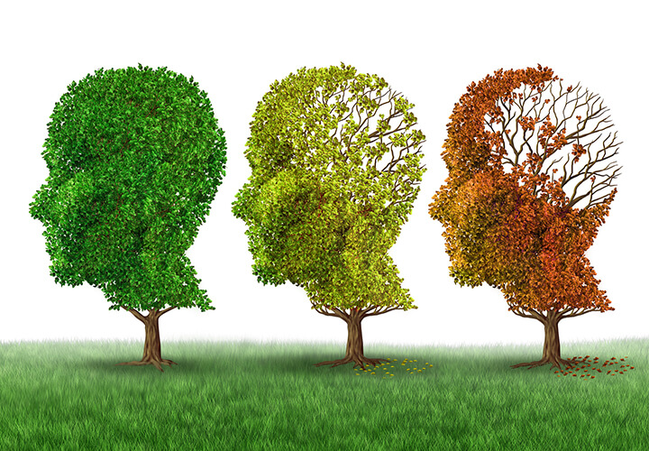 Alzheimer's
